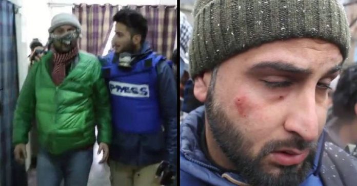 Condemnations galore as journalists hit with pellets in Shopian