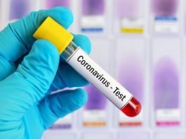 Coronavirus - COVID-19 Test
