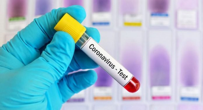 Coronavirus - COVID-19 Test Coronavirus - COVID-19 Test