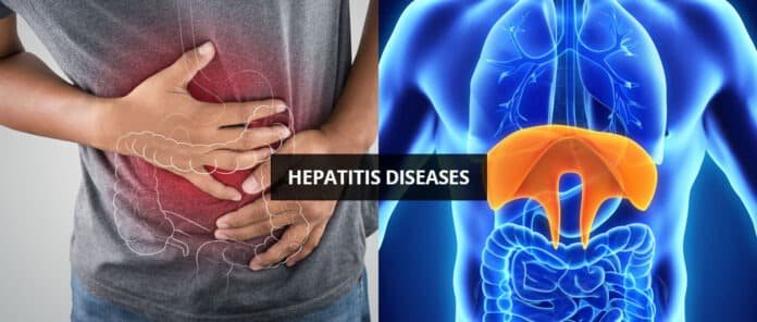 Hepatitis Disease Hepatitis Disease