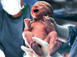 New-born baby - Caesarean delivery