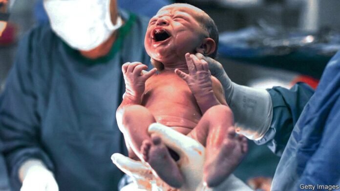 New-born baby - Caesarean delivery