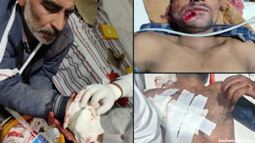 The injured civilians being treated at a hospital in central Kashmir